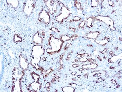 Diagnostic Biosystems&nbsp;NAPSIN A Napsin A