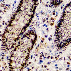 Diagnostic Biosystems&nbsp;BAP1 BAP1 (BAP1/2667)
