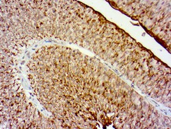 Diagnostic Biosystems&nbsp;UROPLAKIN 11 UPK2 Uroplakin II