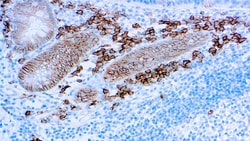 Diagnostic Biosystems&nbsp;CD138 CD138 (B-A38)