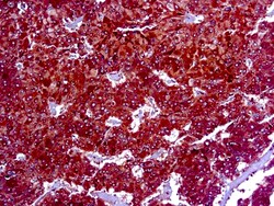 Diagnostic Biosystems&nbsp;ADIPOPHILIN Adipophilin