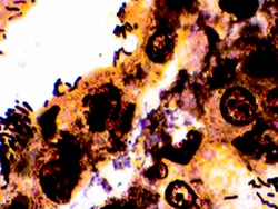 Diagnostic Biosystems WARTHIN-STARRY Warthin-Starry, Quantity: Each of