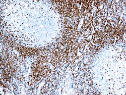 Diagnostic Biosystems CD5 CD5 (SP19), Quantity: Each of 1