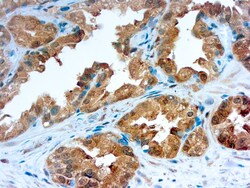 Diagnostic Biosystems&nbsp;GALECTIN-3 Galectin-3