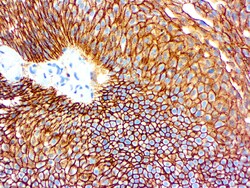 Diagnostic Biosystems&nbsp;CD44 H CAM CD44 /HCAM