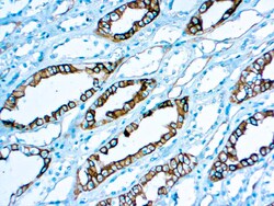 Diagnostic Biosystems RENAL CELL CARCINOMA Renal Cell Carcinoma (gp200)
