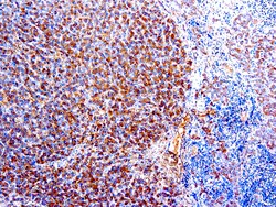 Diagnostic Biosystems&nbsp;ALPHA-1-ANTITRYPSIN Alpha (α )-1-Antitrypsin