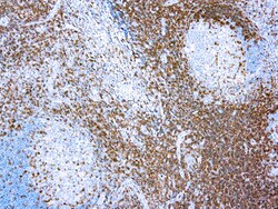 Diagnostic Biosystems CD3 CD3, T Cell