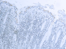 Diagnostic Biosystems HELICOBACTER PYLORI ANTIBODY Helicobacter Pylori