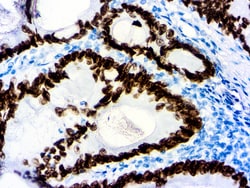 Diagnostic Biosystems&nbsp;SATB2 SATB2 (EP 281)