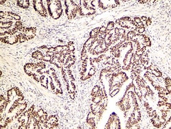 Diagnostic Biosystems PMS2 PMS2