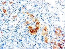 Diagnostic Biosystems&nbsp;INHIBIN Inhibin