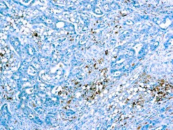Diagnostic Biosystems&nbsp;CATHEPSIN D Cathepsin D