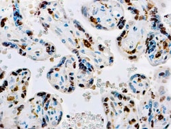 Diagnostic Biosystems FACTOR XIII A Factor XIII-A, Quantity: Each of 1