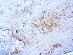 Diagnostic Biosystems TREPONEMA PALLIDUM Treponema Pallidum, Quantity: