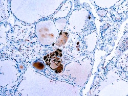 Diagnostic Biosystems&nbsp;CALCITONIN Calcitonin