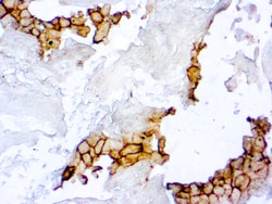 Diagnostic Biosystems&nbsp;PD-L1 PD-L1