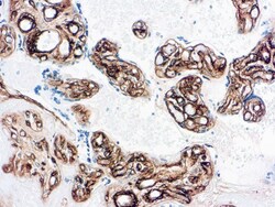 Diagnostic Biosystems COLLAGEN IV Collagen Type IV, Quantity: Each of 1