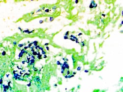 Diagnostic Biosystems&nbsp;GMS GMS