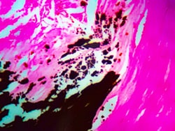 Diagnostic Biosystems&nbsp;VON KOSSA Von Kossa