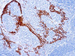 Diagnostic Biosystems CYTOKERATIN 16 Cytokeratin 16, Quantity: Each of