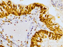 Diagnostic Biosystems&nbsp;MSH2 Mismatch Repair Protein 2, MSH2