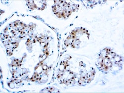 Diagnostic Biosystems PTEN PTEN (Tumor Suppressor), Quantity: Each of 1