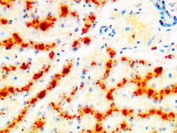Diagnostic Biosystems COPPER STAIN Copper Stain, Quantity: Each of 1