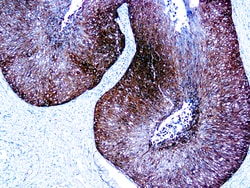 Diagnostic Biosystems&nbsp;P16 p16