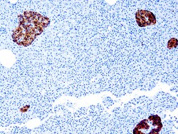 Diagnostic Biosystems CHROMOGRANIN A Chromogranin A (SP12), Quantity: Each