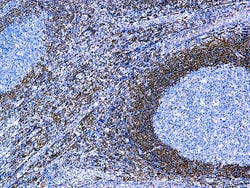 Diagnostic Biosystems&nbsp;BCL-2 ONCOPROTEIN Bcl-2 Oncoprotein