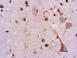 Diagnostic Biosystems AMYLOID PRECURSOR PROTEIN APP Amyloid Precursor Protein