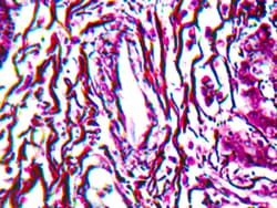 Diagnostic Biosystems RETICULUM STAIN KIT Reticulum Stain Kit, Quantity: