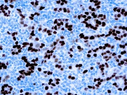 Diagnostic Biosystems&nbsp;PROGESTERONE RECEPTOR PR Progesterone Receptor (PR)