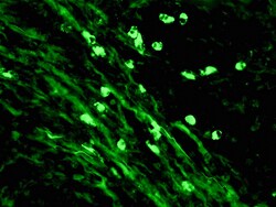 Diagnostic Biosystems IGM-FITC IgM-FITC, Quantity: Each of 1