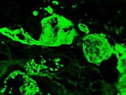 Diagnostic Biosystems FIBRINOGEN-FITC Fibrinogen-FITC