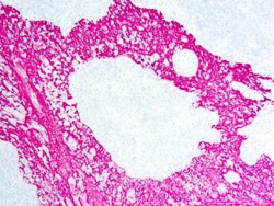 Diagnostic Biosystems&nbsp;PERMARED/AP PermaRed/AP