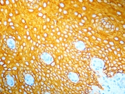 Diagnostic Biosystems&nbsp;PERMAYELLOW/HRP PermaYellow/HRP