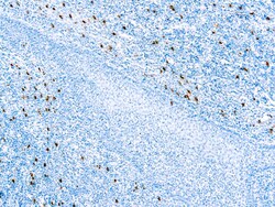 Diagnostic Biosystems&nbsp;MAST CELL TRYPTASE Mast Cell Tryptase