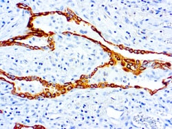 Diagnostic Biosystems&nbsp;CYTOKERATIN 7 Cytokeratin 7 (LP1K)