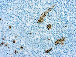 Diagnostic Biosystems MGMT O(6)-Methylguanine-DNAMethyltransferase, MGMT,