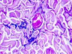 Diagnostic Biosystems&nbsp;COMBINED EOSINOPHIL-MAST CELL Combined Eosinophil-Mast Cell
