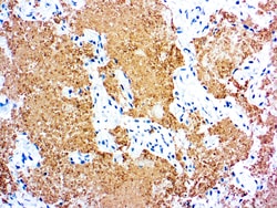 Diagnostic Biosystems&nbsp;PNEUMOCYSTIS CARINII Pneumocystis carinii