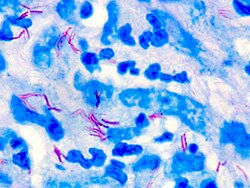 Diagnostic Biosystems FITE STAIN Fite's Stain, Quantity: Each of 1