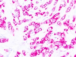 Diagnostic Biosystems&nbsp;EMA Epithelial Membrane Antigen (EMA) E29