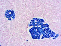 Diagnostic Biosystems SYNAPTOPHYSIN Synaptophysin (SP11), Quantity: Each