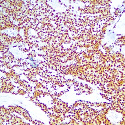 Diagnostic Biosystems&nbsp;OCT 3/4 OCT-3/4 (OCT4/6847R)