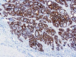 Diagnostic Biosystems&nbsp;CYTOKERATIN 19 Cytokeratin 19 (A53‐B/A2.26 )