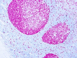 Diagnostic Biosystems&nbsp;KI-67 ANTIGEN Ki-67 Antigen