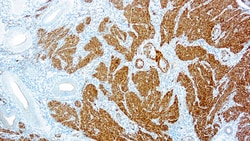 Diagnostic Biosystems CALPONIN Calponin-1, Quantity: Each of 1